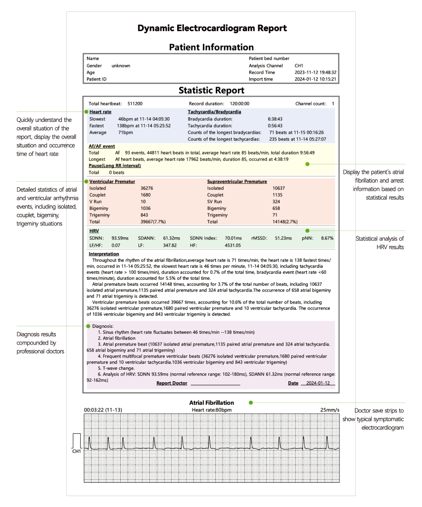 Náhled dynamického EKG reportu