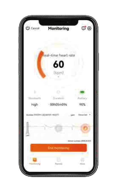Monitorovací aplikace monitorace EKG v reálném čase